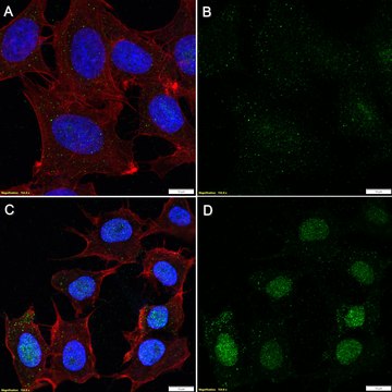 Anti-Poly(ADP-ribose) Antibody, clone 10H ZooMAb&#174; Mouse Monoclonal recombinant, expressed in HEK 293 cells