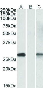 Anti-DYDC1 antibody produced in goat affinity isolated antibody, buffered aqueous solution