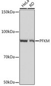 Anti-PFKM Antibody, clone 4Z7X1, Rabbit Monoclonal