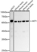 [KO Validated]Anti-AKT1 Antibody, clone 0O8L9, Rabbit Monoclonal