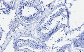 Anti-METTL14 Antibody, clone 2G22 ZooMAb&#174; Rabbit Monoclonal recombinant, expressed in HEK 293 cells