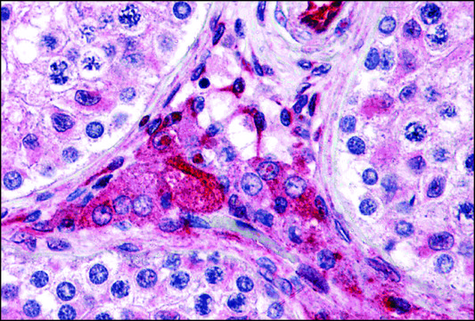Anti-PTCHD2 antibody produced in rabbit affinity isolated antibody