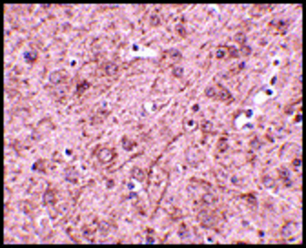 Anti-LASS6 antibody produced in rabbit affinity isolated antibody, buffered aqueous solution