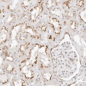 Anti-GNAS antibody produced in rabbit Prestige Antibodies&#174; Powered by Atlas Antibodies, affinity isolated antibody, buffered aqueous glycerol solution, ab1