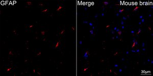 Anti-GFAP Antibody, clone 8M2F9, Rabbit Monoclonal