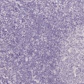 Anti-TMEM174 antibody produced in rabbit Prestige Antibodies&#174; Powered by Atlas Antibodies, affinity isolated antibody, buffered aqueous glycerol solution