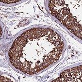 Anti-TUBA1A antibody produced in rabbit Prestige Antibodies&#174; Powered by Atlas Antibodies, affinity isolated antibody, buffered aqueous glycerol solution
