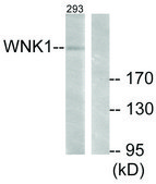 Anti-WNK1 antibody produced in rabbit affinity isolated antibody