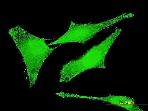 Monoclonal Anti-SET antibody produced in mouse clone M1-F5, purified immunoglobulin, buffered aqueous solution