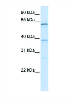 Anti-RBM39 antibody produced in rabbit affinity isolated antibody