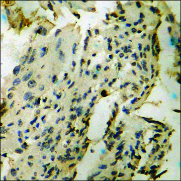 Anti-phospho-NF-kappaB p65 (pThr435) antibody produced in rabbit affinity isolated antibody