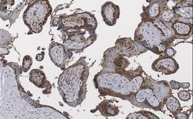 Anti-BCRP (ABCG2) Antibody, clone 10K5 , ZooMAb&#174; Rabbit Monoclonal recombinant, expressed in HEK 293 cells