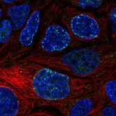 Anti-CACNA1D antibody produced in rabbit Prestige Antibodies&#174; Powered by Atlas Antibodies, affinity isolated antibody, buffered aqueous glycerol solution