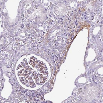 Anti-ATP10A antibody produced in rabbit Prestige Antibodies&#174; Powered by Atlas Antibodies, affinity isolated antibody, buffered aqueous glycerol solution