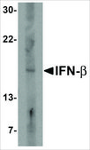 Anti-IFN-&#946; antibody produced in rabbit affinity isolated antibody, buffered aqueous solution