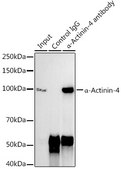 Anti-&#945;-Actinin-4 Antibody, clone 5Y3R6, Rabbit Monoclonal