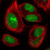 Anti-ZNF593 antibody produced in rabbit Prestige Antibodies&#174; Powered by Atlas Antibodies, affinity isolated antibody, buffered aqueous glycerol solution