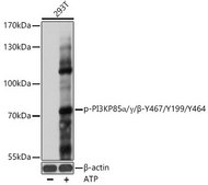 Anti-Phospho-PI3KP85&#945;/&#947;/&#946;-Y467/Y199/Y464 antibody produced in rabbit