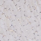 Anti-TJP1 antibody produced in rabbit Ab2, Prestige Antibodies&#174; Powered by Atlas Antibodies, affinity isolated antibody, buffered aqueous glycerol solution