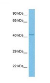 Anti-OTC antibody produced in rabbit affinity isolated antibody
