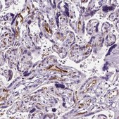 Anti-VWF antibody produced in rabbit Ab2, Prestige Antibodies&#174; Powered by Atlas Antibodies, affinity isolated antibody, buffered aqueous glycerol solution