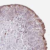 Anti-SERPINE1 antibody produced in rabbit Prestige Antibodies&#174; Powered by Atlas Antibodies, affinity isolated antibody, buffered aqueous glycerol solution
