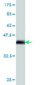 Monoclonal Anti-TWIST1 antibody produced in mouse clone 3E11, purified immunoglobulin, buffered aqueous solution
