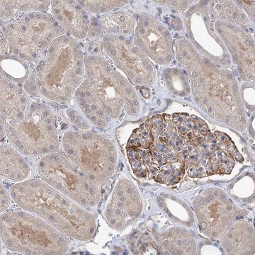 Anti-RWDD4 antibody produced in rabbit Prestige Antibodies&#174; Powered by Atlas Antibodies, affinity isolated antibody, buffered aqueous glycerol solution