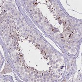 Anti-FAM209B antibody produced in rabbit Prestige Antibodies&#174; Powered by Atlas Antibodies, affinity isolated antibody, buffered aqueous glycerol solution