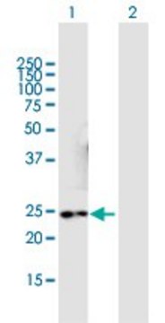 Anti-NMNAT3 antibody produced in mouse purified immunoglobulin, buffered aqueous solution