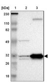 Anti-ECH1 antibody produced in rabbit Prestige Antibodies&#174; Powered by Atlas Antibodies, affinity isolated antibody, buffered aqueous glycerol solution
