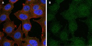 Anti-phospho-Stat1-Tyr701 Antibody, clone 1F23 ZooMAb&#174; Rabbit Monoclonal recombinant, expressed in HEK 293 cells