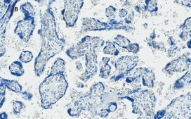 Anti-GLUT-1 Antibody, CT, clone 16D21, ZooMAb&#174; Rabbit Monoclonal recombinant, expressed in HEK 293 cells
