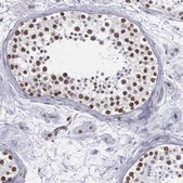 Anti-NKAP antibody produced in rabbit Prestige Antibodies&#174; Powered by Atlas Antibodies, affinity isolated antibody, buffered aqueous glycerol solution