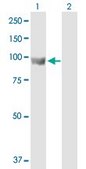 Anti-ELAC2 antibody produced in mouse purified immunoglobulin, buffered aqueous solution