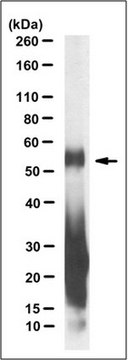 Anti-C9ORF72/C9RANT (poly-GA) Antibody, clone 5E9 clone 5E9, from mouse