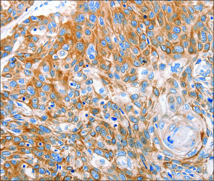 Anti-LRP2 antibody produced in rabbit affinity isolated antibody