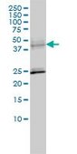 Monoclonal Anti-SERPINA6 antibody produced in mouse clone 1D9, purified immunoglobulin, buffered aqueous solution