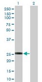 Anti-GSTO2 antibody produced in rabbit purified immunoglobulin, buffered aqueous solution