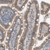 Anti-FDFT1 antibody produced in rabbit affinity isolated antibody, buffered aqueous glycerol solution