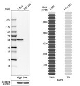 Anti-G6PD antibody produced in rabbit Prestige Antibodies&#174; Powered by Atlas Antibodies, affinity isolated antibody, buffered aqueous glycerol solution