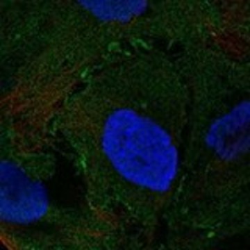 Anti-NMUR2 antibody produced in rabbit Prestige Antibodies&#174; Powered by Atlas Antibodies, affinity isolated antibody, buffered aqueous glycerol solution