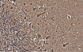 Anti-Aldolase C Antibody, clone 3B18, ZooMAb&#174; Rabbit Monoclonal recombinant, expressed in HEK 293 cells
