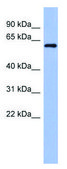 Anti-RBM47 antibody produced in rabbit affinity isolated antibody