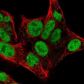 Anti-CHEK2 antibody produced in rabbit Prestige Antibodies&#174; Powered by Atlas Antibodies, affinity isolated antibody, buffered aqueous glycerol solution