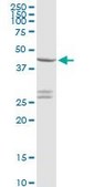 Anti-CXADR antibody produced in rabbit purified immunoglobulin, buffered aqueous solution