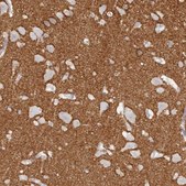 Anti-TNR antibody produced in rabbit Prestige Antibodies&#174; Powered by Atlas Antibodies, affinity isolated antibody, buffered aqueous glycerol solution