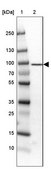 Anti-TARS antibody produced in rabbit Prestige Antibodies&#174; Powered by Atlas Antibodies, affinity isolated antibody, buffered aqueous glycerol solution