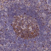 Anti-YBX1 antibody produced in rabbit Prestige Antibodies&#174; Powered by Atlas Antibodies, affinity isolated antibody, buffered aqueous glycerol solution