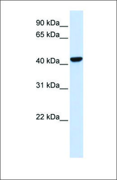 Anti-CTH antibody produced in rabbit affinity isolated antibody